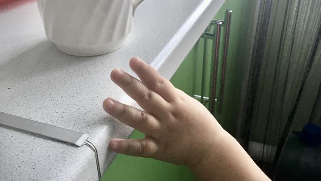 В Бузулукском районе 9-месячный малыш сильно обжегся кипятком