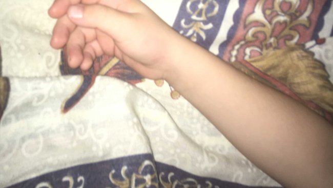 В Бузулуке произошел несчастный случай с 8-летним ребёнком 