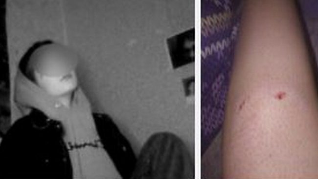 В Бузулуке четыре собаки набросились на подростка