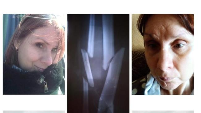 Бузулучанка, которую сбила машина, ищет справедливости 