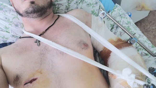 Пострадавший от рук «бузулукского стрелка» рассказал о происшествии (18+)