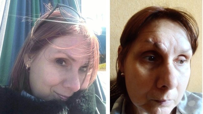 Бузулучанка, серьезно пострадавшая в ДТП, ждёт справедливого решения суда