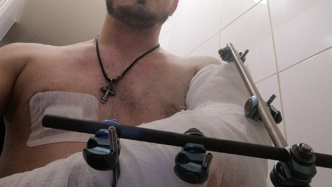 Жертва «бузулукского стрелка» до сих пор ждёт очной ставки с задержанным