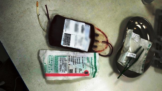 Какие преимущества есть у доноров, и кто категорически не подходит на эту «роль»?