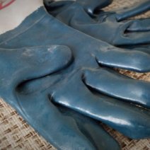 Бузулучанину, который едва не сгорел заживо, пришлось судится с работодателем 